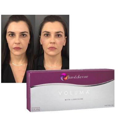 Juvederm Dermal Lip Fillers Hyaluronic Acid ক্রস লিঙ্কড ইনজেকশন