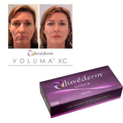 ঝাঁকুনি সংশোধন Juvederm Dermal Filler Hyaluronic Acid ইনজেকশনযোগ্য জেল দীর্ঘস্থায়ী মসৃণকরণ চিকিত্সা